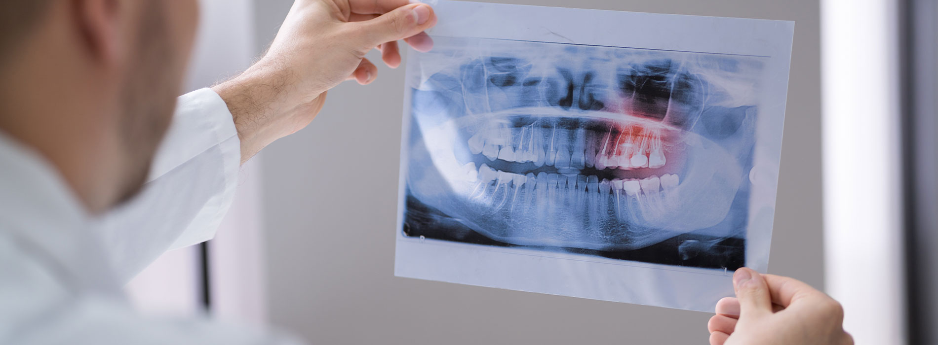 Orofacial   Dental Implant Surgery | Impacted Wisdom Teeth, Wisdom Teeth Removal and Distraction Osteogenesis